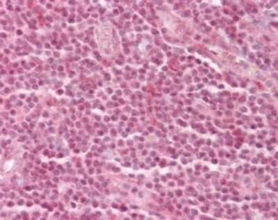 Immunohistochemistry-Paraffin: p66 alpha Antibody [NB100-56643]