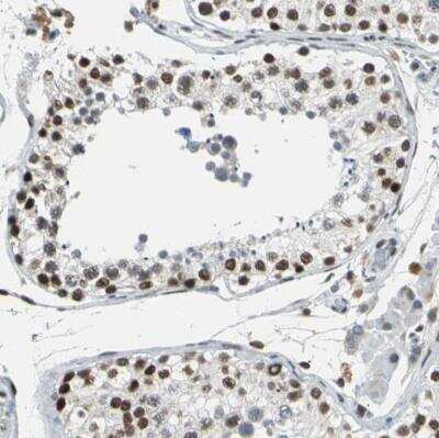 Immunohistochemistry-Paraffin: p66 alpha Antibody [NBP1-87359]