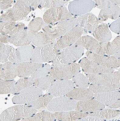 Immunohistochemistry-Paraffin: p66 alpha Antibody [NBP1-87359]