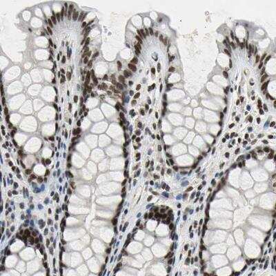 Immunohistochemistry-Paraffin: p66 alpha Antibody [NBP1-87359]