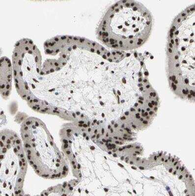 Immunohistochemistry-Paraffin: p66 alpha Antibody [NBP1-87359]