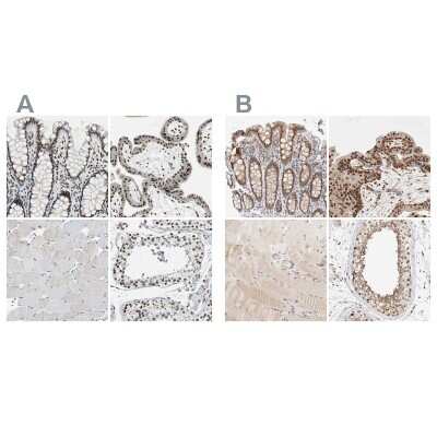 Immunohistochemistry-Paraffin: p66 alpha Antibody [NBP1-87359]