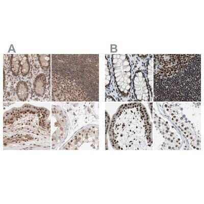 Immunohistochemistry-Paraffin: p66 alpha Antibody [NBP1-87360]