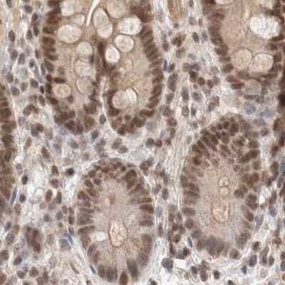 Immunohistochemistry-Paraffin: p66 alpha Antibody [NBP1-87360]