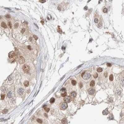 Immunohistochemistry-Paraffin: p66 alpha Antibody [NBP1-87360]