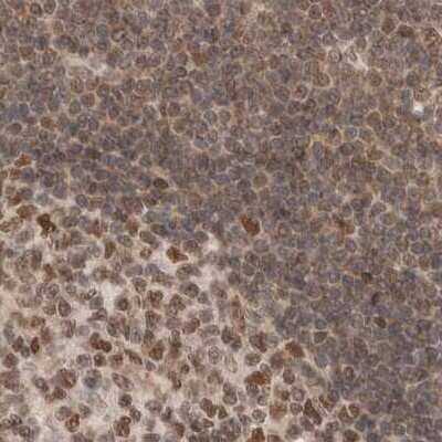 Immunohistochemistry-Paraffin: p66 alpha Antibody [NBP1-87360]