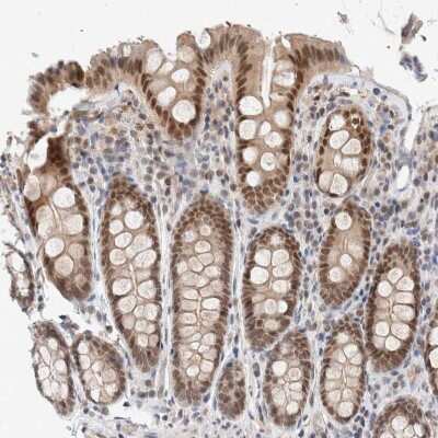 Immunohistochemistry-Paraffin: p66 alpha Antibody [NBP1-87360]