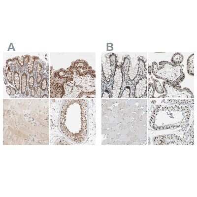 Immunohistochemistry-Paraffin: p66 alpha Antibody [NBP1-87360]