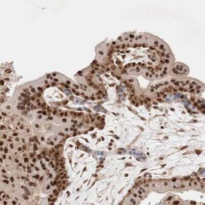 Immunohistochemistry-Paraffin: p66 alpha Antibody [NBP1-87360]