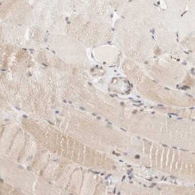 Immunohistochemistry-Paraffin: p66 alpha Antibody [NBP1-87360]