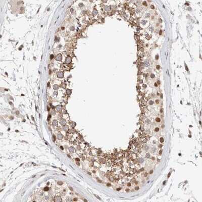 Immunohistochemistry-Paraffin: p66 alpha Antibody [NBP1-87360]