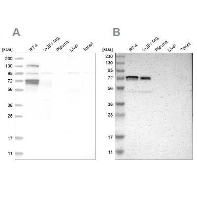 Western Blot: p66 alpha Antibody [NBP1-87360]