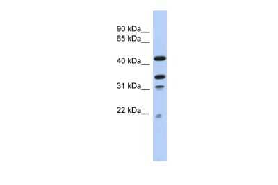 Western Blot: p66 alpha Antibody [NBP2-88000]