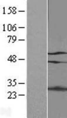 Western Blot: p66 alpha Overexpression Lysate [NBP2-06953]