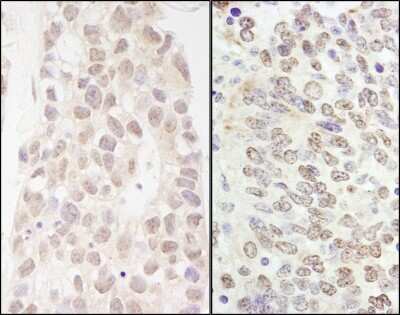 Immunohistochemistry: p66 beta Antibody [NB100-60646]