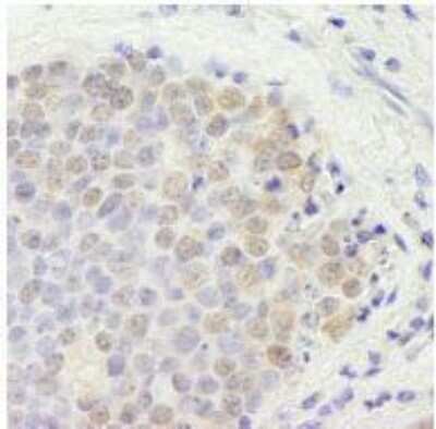 Immunohistochemistry-Paraffin: p66 beta Antibody [NB100-60646]