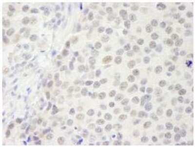 Immunohistochemistry-Paraffin: p66 beta Antibody [NB100-60646]