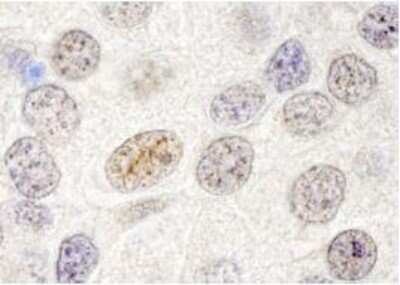 Immunohistochemistry-Paraffin: p66 beta Antibody [NB100-60646]