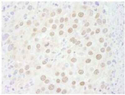 Immunohistochemistry-Paraffin: p66 beta Antibody [NB100-60646]
