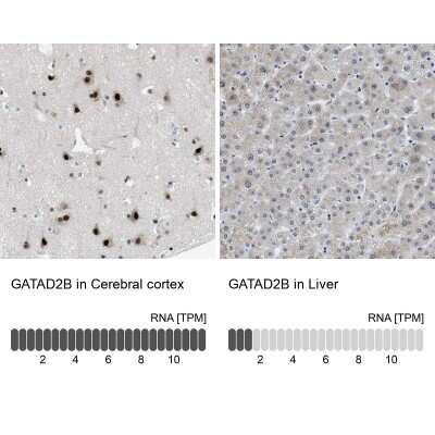 Immunohistochemistry-Paraffin: p66 beta Antibody [NBP1-87358]