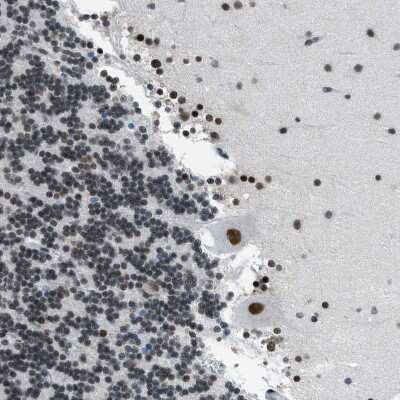 Immunohistochemistry-Paraffin: p66 beta Antibody [NBP1-87358]