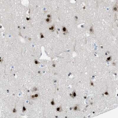 Immunohistochemistry-Paraffin: p66 beta Antibody [NBP1-87358]