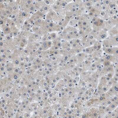 Immunohistochemistry-Paraffin: p66 beta Antibody [NBP1-87358]