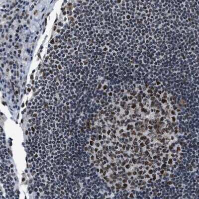 Immunohistochemistry-Paraffin: p66 beta Antibody [NBP1-87358]
