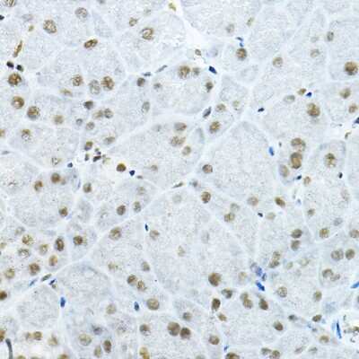 Immunohistochemistry-Paraffin: p66 beta Antibody - BSA Free [NBP2-93311]