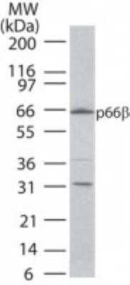 Western Blot: p66 beta Antibody [NB100-56387]