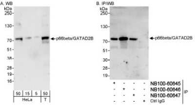 Western Blot: p66 beta Antibody [NB100-60645]
