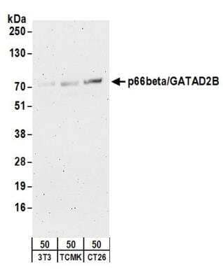 Western Blot: p66 beta Antibody [NB100-60645]