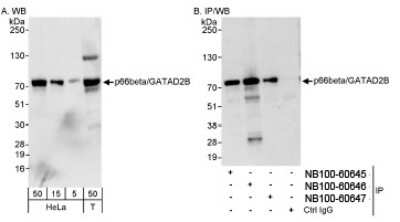 Western Blot: p66 beta Antibody [NB100-60646]