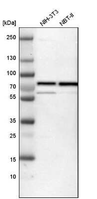 Western Blot: p66 beta Antibody [NBP1-87358]