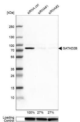 Western Blot: p66 beta Antibody [NBP1-87358]