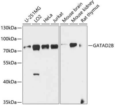 Western Blot: p66 beta AntibodyBSA Free [NBP2-93311]