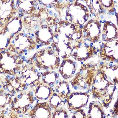 Immunohistochemistry-Paraffin: p67phox/NOXA2 Antibody (7J7N3) [NBP3-16257]