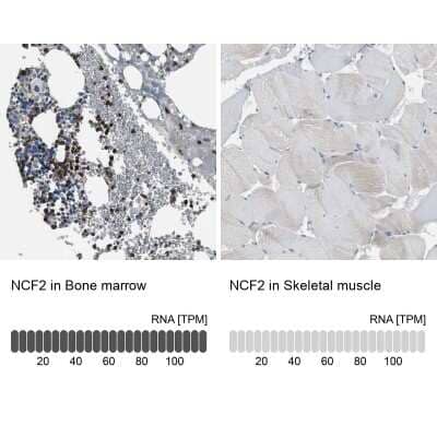 Immunohistochemistry-Paraffin: p67phox/NOXA2 Antibody [NBP1-82542]