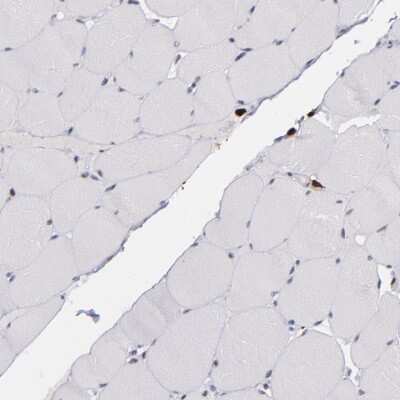 Immunohistochemistry-Paraffin: p67phox/NOXA2 Antibody [NBP1-82543]