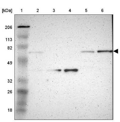 Western Blot: p67phox/NOXA2 Antibody [NBP1-82543]