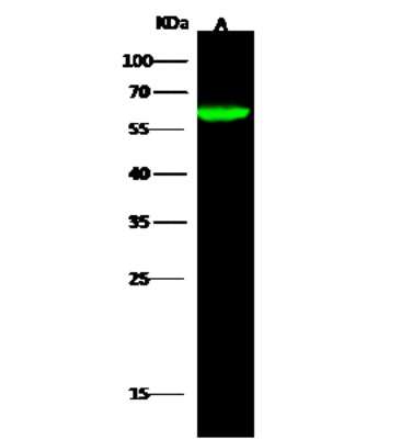 Western Blot: p67phox/NOXA2 Antibody [NBP2-97097]