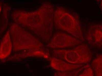 Immunocytochemistry/ Immunofluorescence: p70 S6 Kinase/S6K [p Ser411] Antibody [NB100-82120]