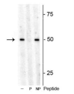 Western Blot: p70 S6 Kinase/S6K [p Thr449] Antibody [NBP3-11951]