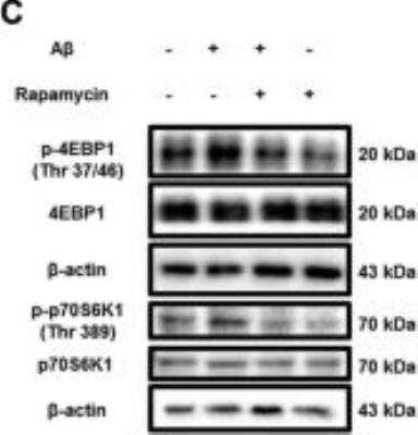 Western Blot: p70 S6 Kinase/S6K [p Thr389/412] Antibody [NB600-1049]