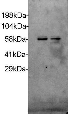 Western Blot: p70 S6 Kinase/S6K Antibody (4H4) [H00006198-M04]