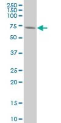 Western Blot: p70 S6 Kinase/S6K Antibody (4H4) [H00006198-M04]
