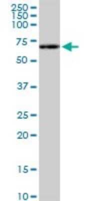 Western Blot: p70 S6 Kinase/S6K Antibody (4H4) [H00006198-M04]