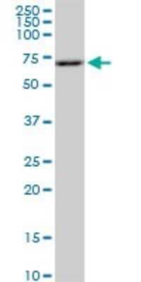 Western Blot: p70 S6 Kinase/S6K Antibody (4H4) [H00006198-M04]