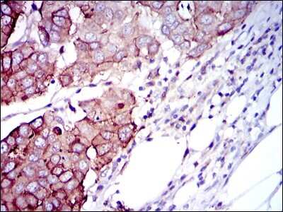 Immunohistochemistry-Paraffin: p70 S6 Kinase/S6K Antibody (5G9) - BSA Free [NBP2-22205]