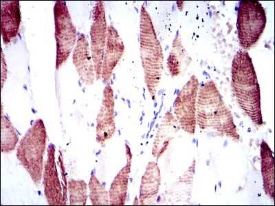 Immunohistochemistry-Paraffin: p70 S6 Kinase/S6K Antibody (5G9) - BSA Free [NBP2-22205]